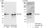 Detection of human and mouse SAE2 by western blot (h&amp;m) and immunoprecipitation (h).