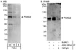 Detection of human FOXC2 by western blot and immunoprecipitation.