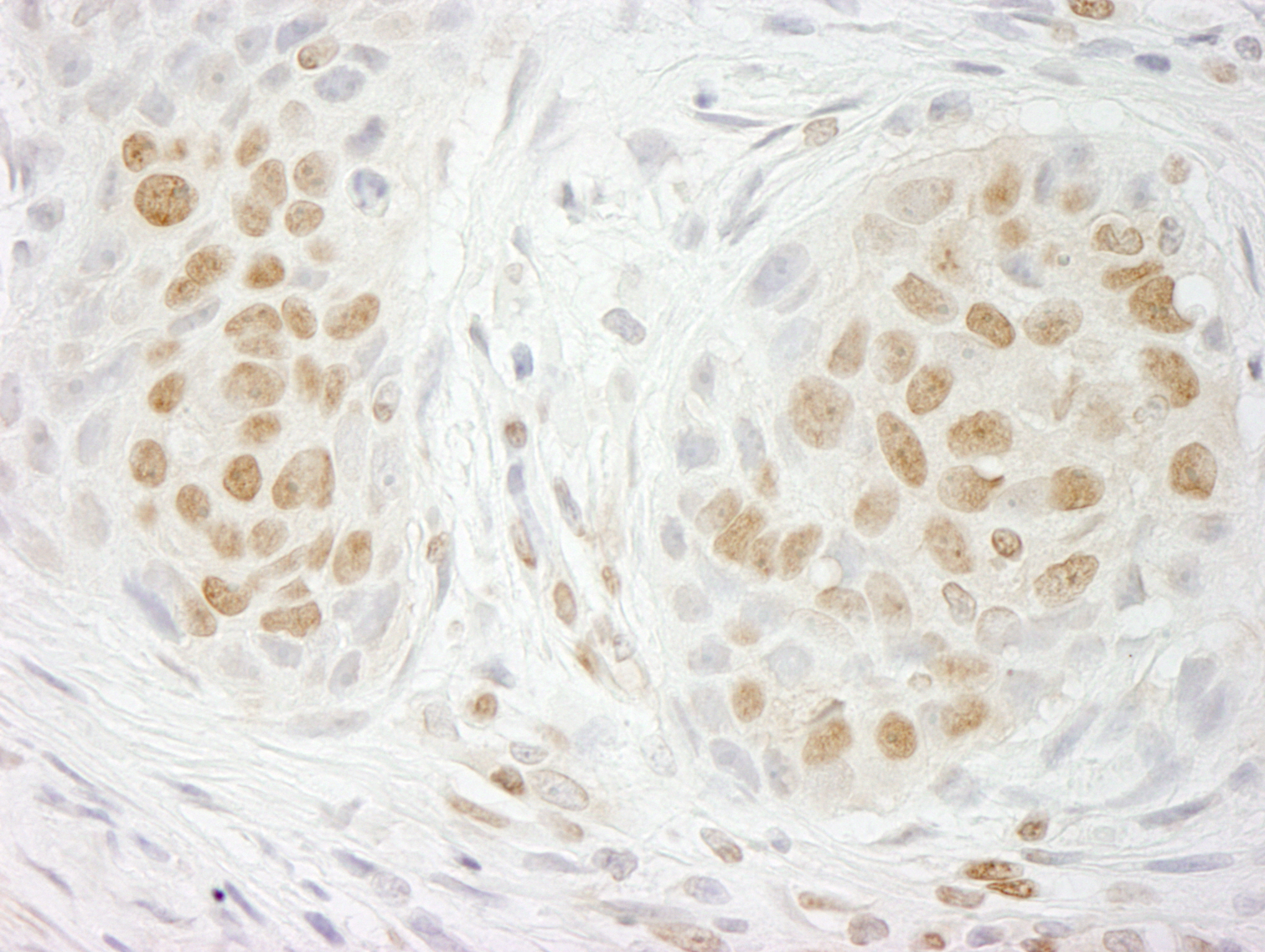 Rabbit anti-GIT2 IHC Antibody