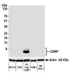 Detection of mouse CGRP by western blot.