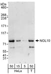 Detection of human NOL10 by western blot.