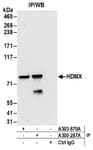Detection of human HDMX by western blot of immunoprecipitates.