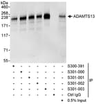 Detection of human ADAMTS13 by western blot and immunoprecipitation.