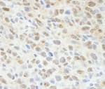 Detection of mouse Sin1 by immunohistochemistry.