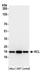 Detection of human RCL by western blot.