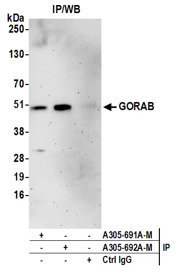 Detection of human GORAB by western blot of immunoprecipitates.