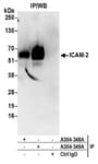 Detection of human ICAM-2 by western blot of immunoprecipitates.