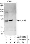 Detection of human DGCR8 by western blot of immunoprecipitates.