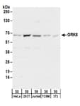 Detection of human and mouse GRK6 by western blot.