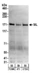 Detection of mouse SIL by western blot.