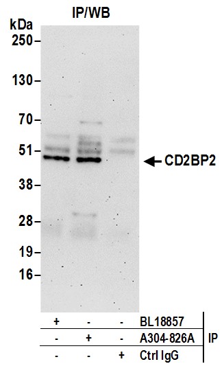 Detection of human CD2BP2 by western blot of immunoprecipitates.