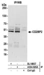 Detection of human CD2BP2 by western blot of immunoprecipitates.