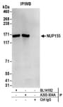 Detection of human NUP155 by western blot of immunoprecipitates.