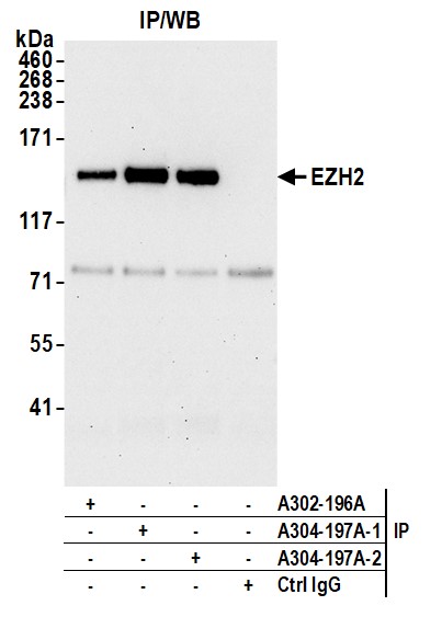 Detection of human EZH2 by western blot of immunoprecipitates.