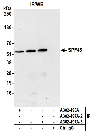 Detection of human SPF45 by western blot of immunoprecipitates.