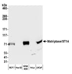 Detection of human Matriptase/ST14 by western blot.