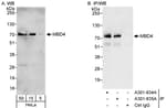 Detection of human MBD4 by western blot and immunoprecipitation.