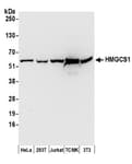 Detection of human and mouse HMGCS1 by western blot.