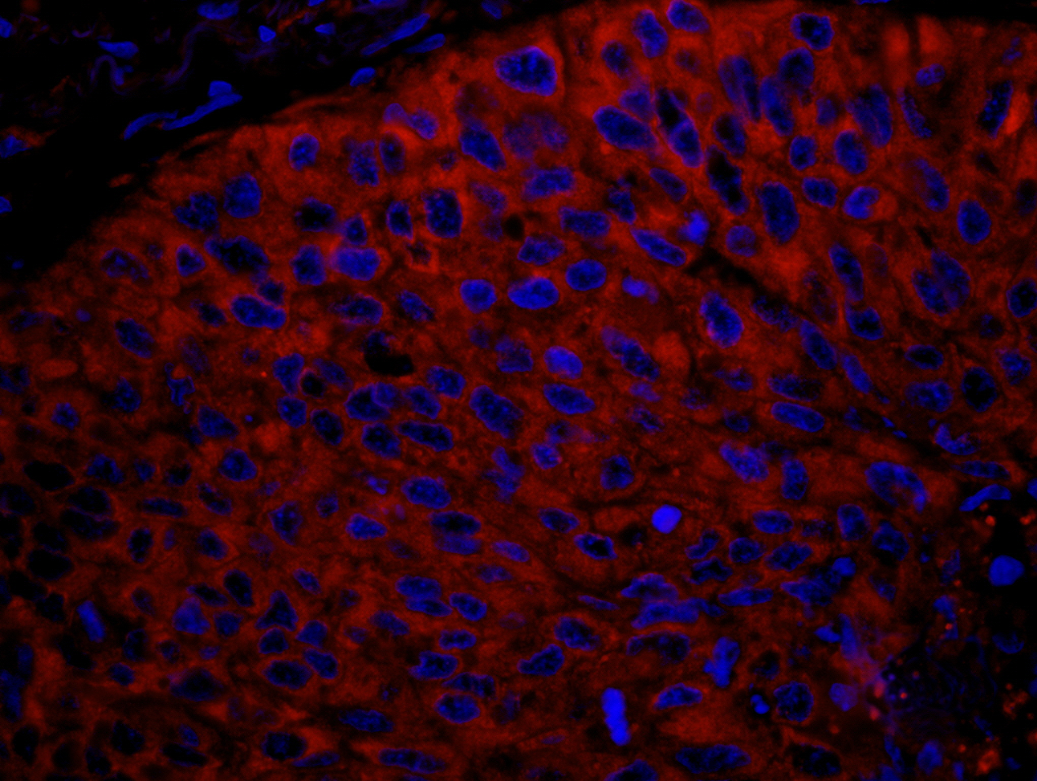Rabbit anti-RPL7 IHC Antibody
