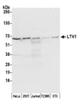 Detection of human and mouse LTV1 by western blot.