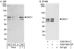 Detection of human DKC1 by western blot and immunoprecipitation.