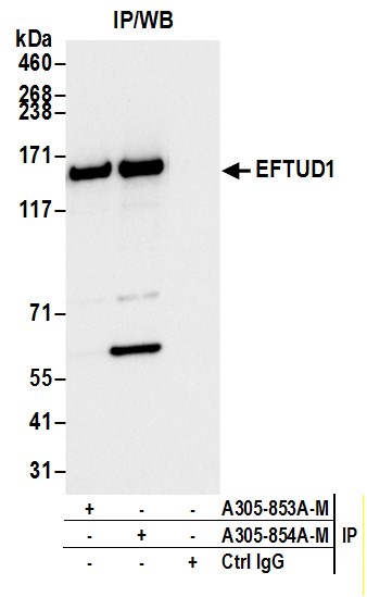 Detection of human EFTUD1 by western blot of immunoprecipitates.