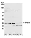 Detection of human and mouse RAB21 by western blot.