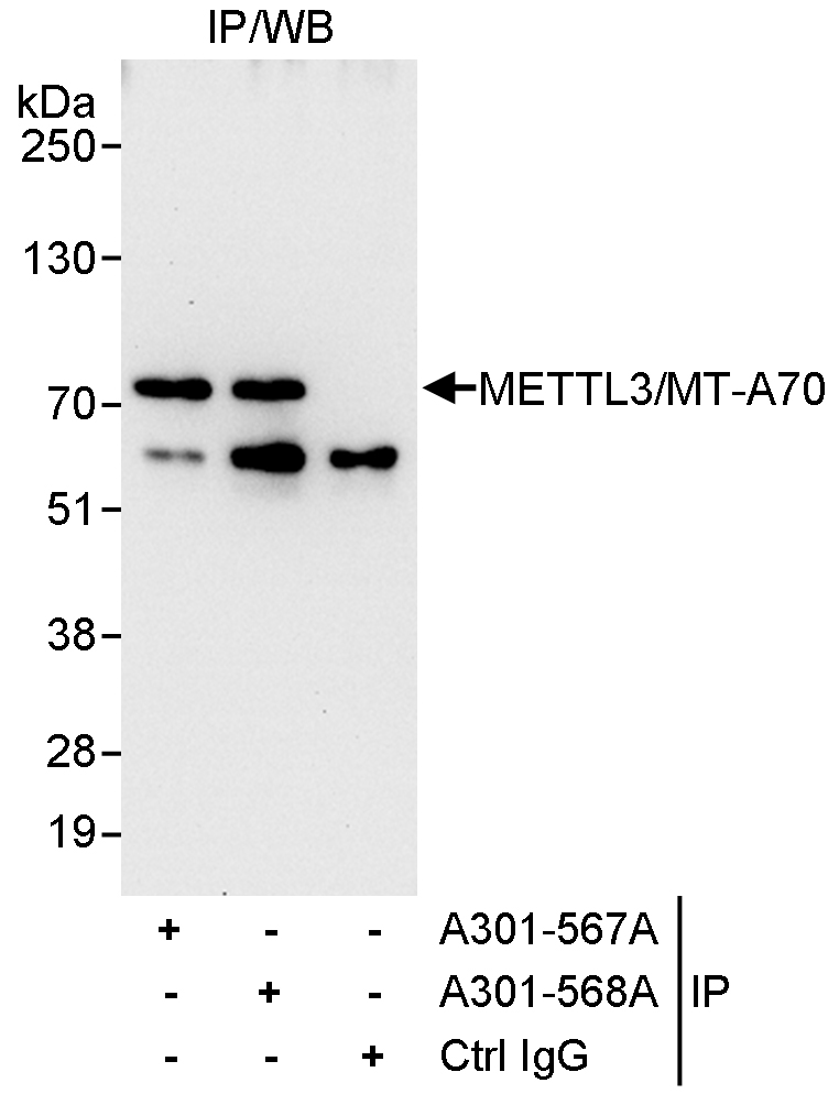 Detection of human METTL3/MT-A70 by western blot of immunoprecipitates.