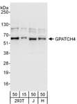 Detection of human GPATCH4 by western blot.