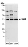 Detection of human SNX8 by western blot.
