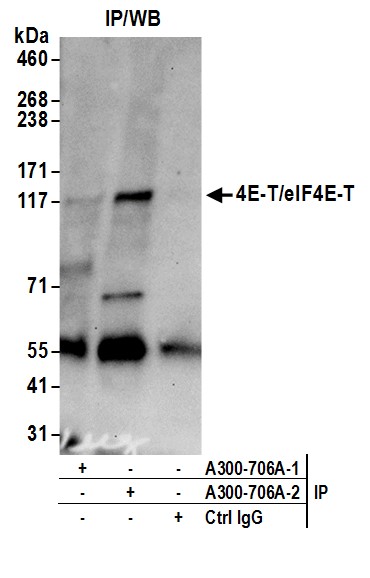Detection of human 4E-T/eIF4E-T by western blot of immunoprecipitates.