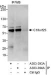 Detection of human C18orf25 by western blot of immunoprecipitates.