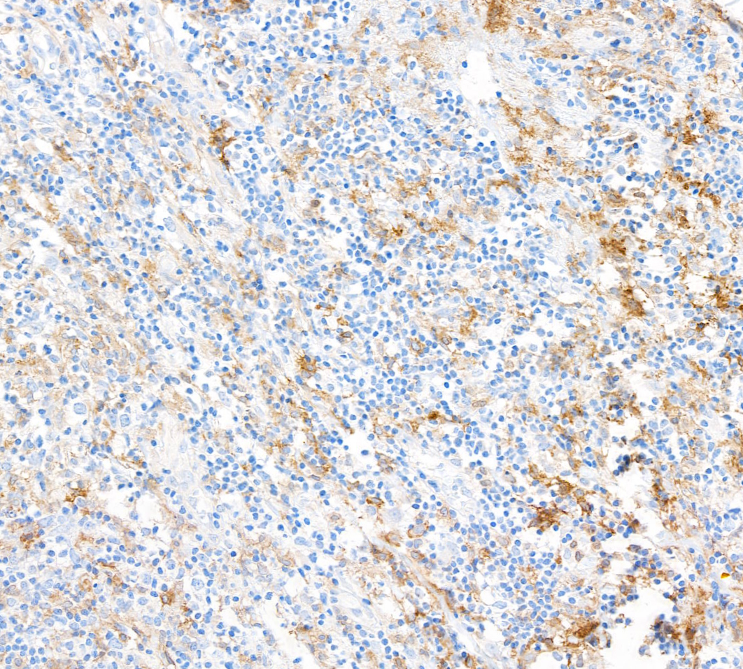 Rabbit anti-CD16A Recombinant Monoclonal Antibody [BLR162J]