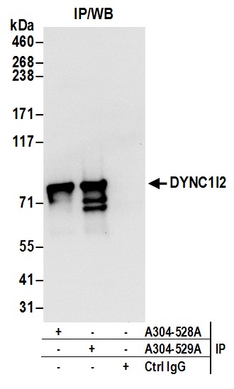 Detection of human DYNC1I2 by western blot of immunoprecipitates.