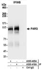 Detection of human PARG by western blot of immunoprecipitates.