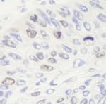 Detection of human Topo II Alpha by immunohistochemistry.