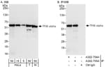 Detection of human and mouse GTF2E1/TFIIE-alpha by western blot (h&amp;m) and immunoprecipitation (h).