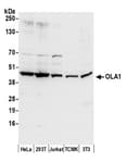 Detection of human and mouse OLA1 by western blot.