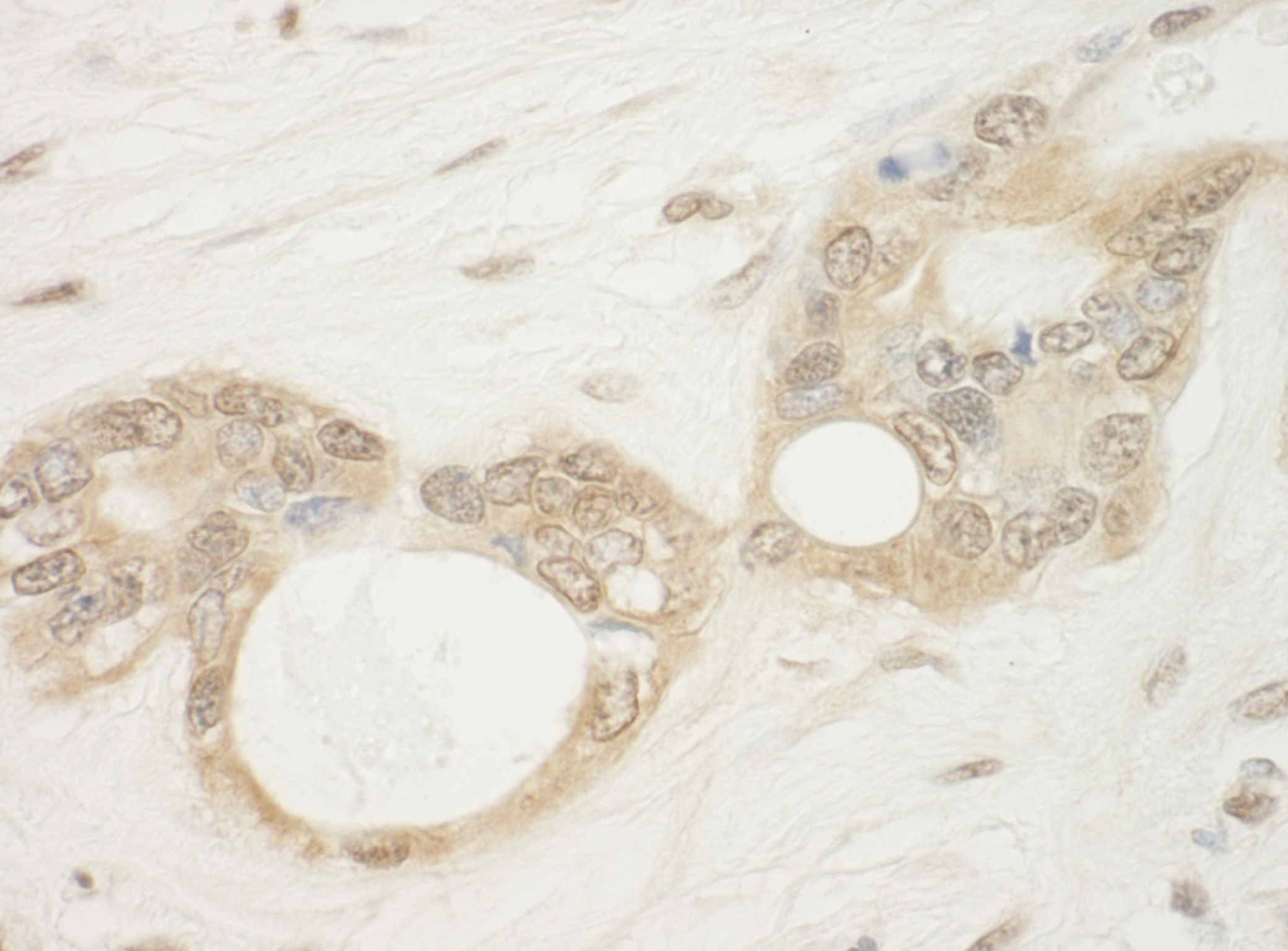 Rabbit anti-WDR5 IHC Antibody