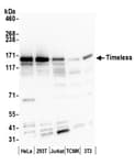 Detection of human and mouse Timeless by western blot.