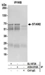 Detection of human STAM2 by western blot of immunoprecipitates.