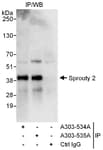 Detection of human Sprouty 2 by western blot of immunoprecipitates.