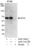 Detection of human ETV3 by western blot of immunoprecipitates.