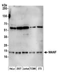 Detection of human and mouse MANF by western blot.