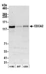 Detection of human CDCA2 by western blot.