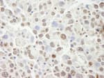 Detection of mouse PHF6 by immunohistochemistry.