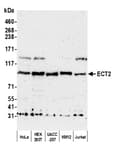 Detection of human ECT2 by western blot.