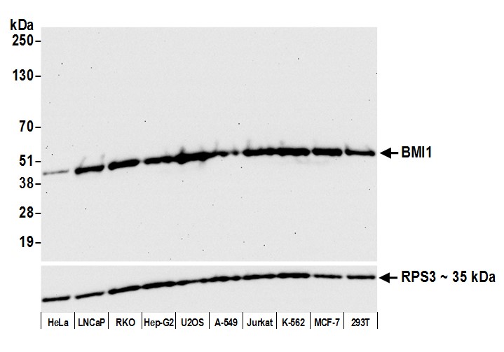 Detection of human BMI1 by western blot.