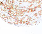 Detection of human HER3/ErbB3 by immunohistochemistry.