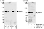 Detection of human and mouse PPM1G by western blot (h&amp;m) and immunoprecipitation (h).